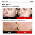 BestBy12/26 FRANKLY Retinol 0.1% Cream 1.01oz Night Anti-Aging Korean Skin Care by Deal US