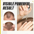 BEST BY 03/12/2027 HOPEMATE Biotin Hair Growth Serum 3.21oz Natural Ingredients by Deal US