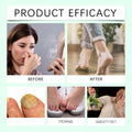 Generic Foot Sanitizer Spray with Tea Tree Oil Clear 1PCS by Deal US
