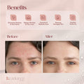 Radiance Snail Mucin Serum 96% Mucin Hyaluronic Acid 100ml Korean Skin Care LIKE by Deal US
