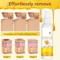 Plresen Bee Venom Skin Treatment Spray Hydrating Moisturizing 2.02oz 2PCS by Deal US