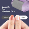Yreihn Electric Callus Remover for Feet Purple 1 Count ABS Material by Deal US