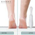 Riorre Professional 3-in-1 Foot Scrubber Callus Remover White Pack 1 by Deal US