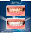 BetterWhite Teeth Whitening Strips 14 Peroxide-Free Professional 7 Treatments by Deal US