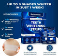 BetterWhite Teeth Whitening Strips 14 Peroxide-Free Professional 7 Treatments by Deal US