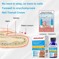 Toenail Fungus Treatment Extra Strength Nail Repair Foot Care by Deal US