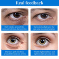 BLIGGLE Under Eye Patches 64 pcs Brightening Hyaluronic Acid Cooling Care by Deal US