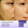 BestBy02/26 depology Blemish & Tone Toner Pads 100 Pads Sensitive Skin by Deal US