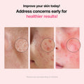 VEGANIFECT Pore Refining Ampoule Tightening Reduce Sebum 1.69oz by Deal US