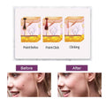 Portable Multi Level Beauty Equipment by DailySale
