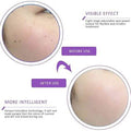 Portable Multi Level Beauty Equipment by DailySale