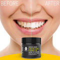 S520 Sonic Toothbrush - Accessories and Activated Coconut Charcoal Powder by DailySale