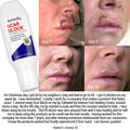 Scar Block Silicone Gel for New and Old Scars by TriDerma MD