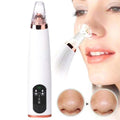 Visual Pore Cleaning Vacuum with Built in Camera by DailySale