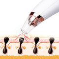 Visual Pore Cleaning Vacuum with Built in Camera by DailySale