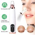 Visual Pore Cleaning Vacuum with Built in Camera by DailySale
