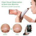 Visual Pore Cleaning Vacuum with Built in Camera by DailySale